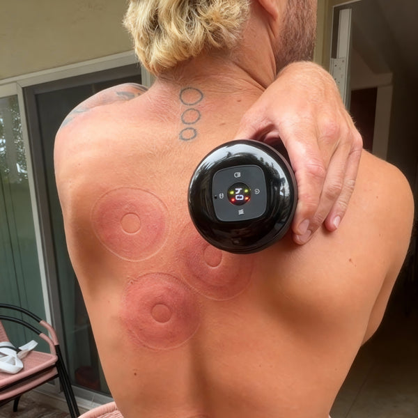 Guide Complet : Ventouses Intelligentes vs Ventouses Classiques